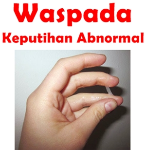 Illustration for article titled Obat keputihan kuning